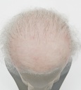 ATB GUNDUL Silicone Bald Wig with thinning hair on top