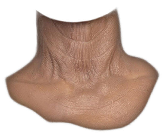 MFX Unisex Old Age Neck 70+ years