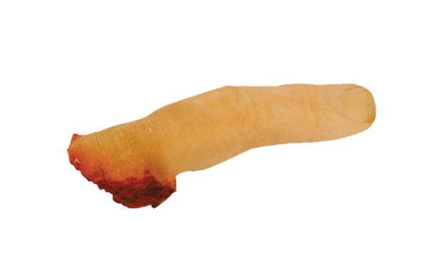TIGA-D Abgetrennter Finger, rechts