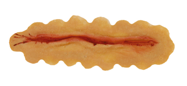 TIGA-D Kleine Schnittwunde PU-Schaumstoff