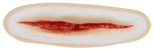 TIGA-D Wunde 1 Silikon