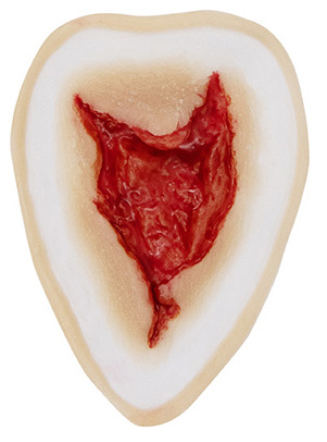 TIGA-D Wound 3 Silicone