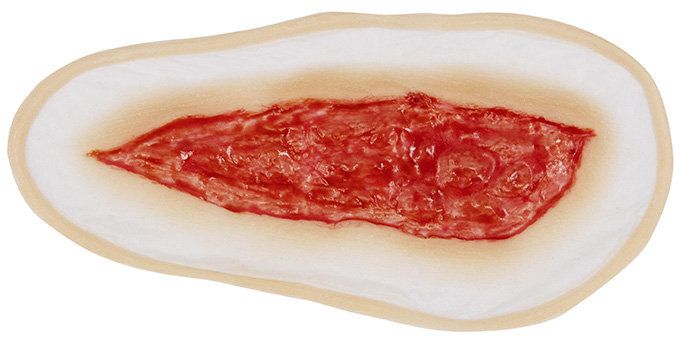 TIGA-D Wound 4 Silicone