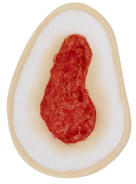 TIGA-D Wound 5 Silicone