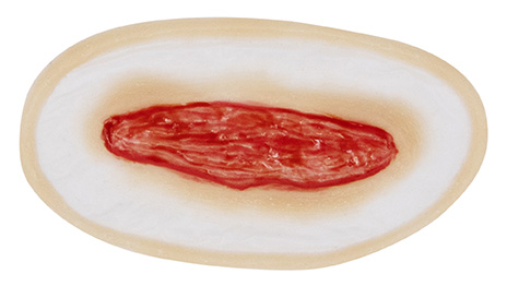 TIGA-D Wound 7 Silicone