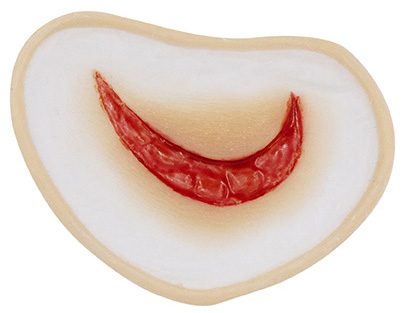 TIGA-D Wunde 9 Silikon