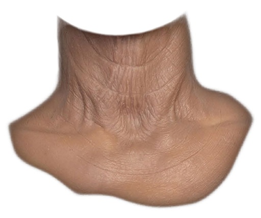 [72.OAN70] MFX Unisex Old Age Neck 70+ years